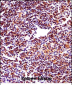 RBM22 Antibody (Center)